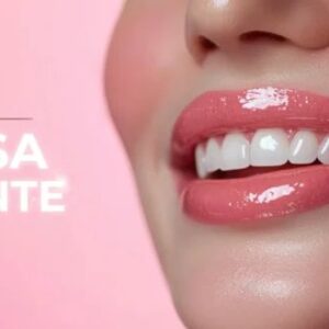 Sesión de Blanqueamiento dental